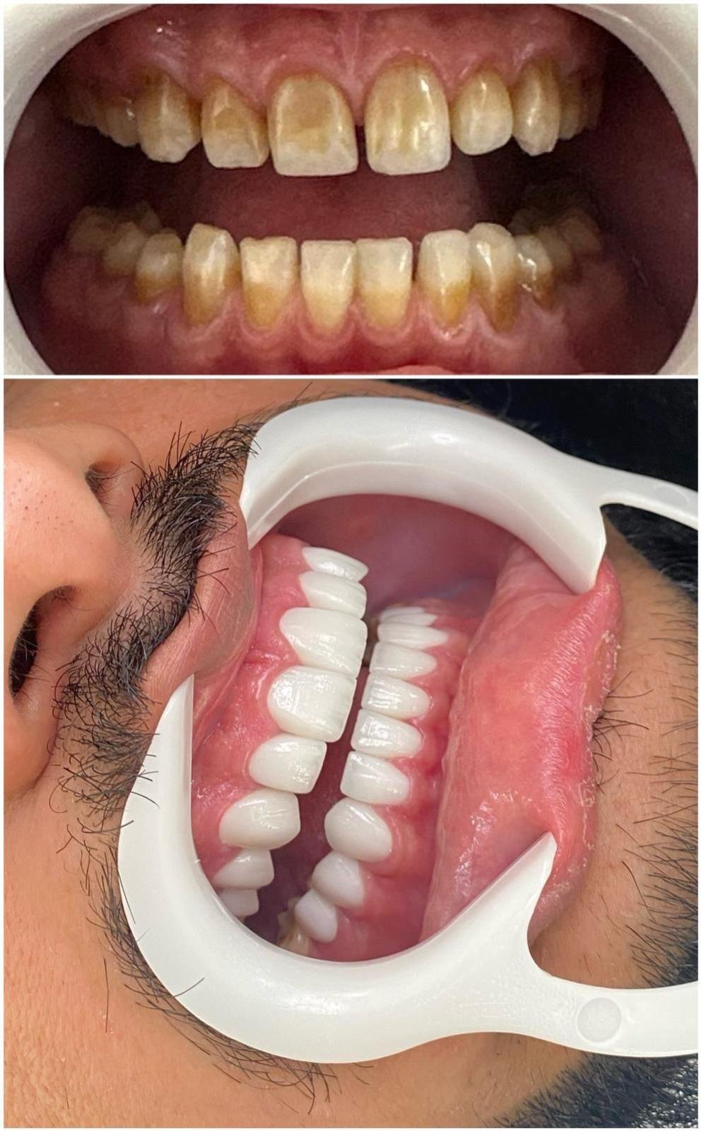 Best Dermatologist in Qatar | Clinica Joelle Doha – Luxury Skincare & Aesthetic Clinic